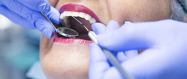 Best Emergency Root Canal Treatment in Southaven, MS